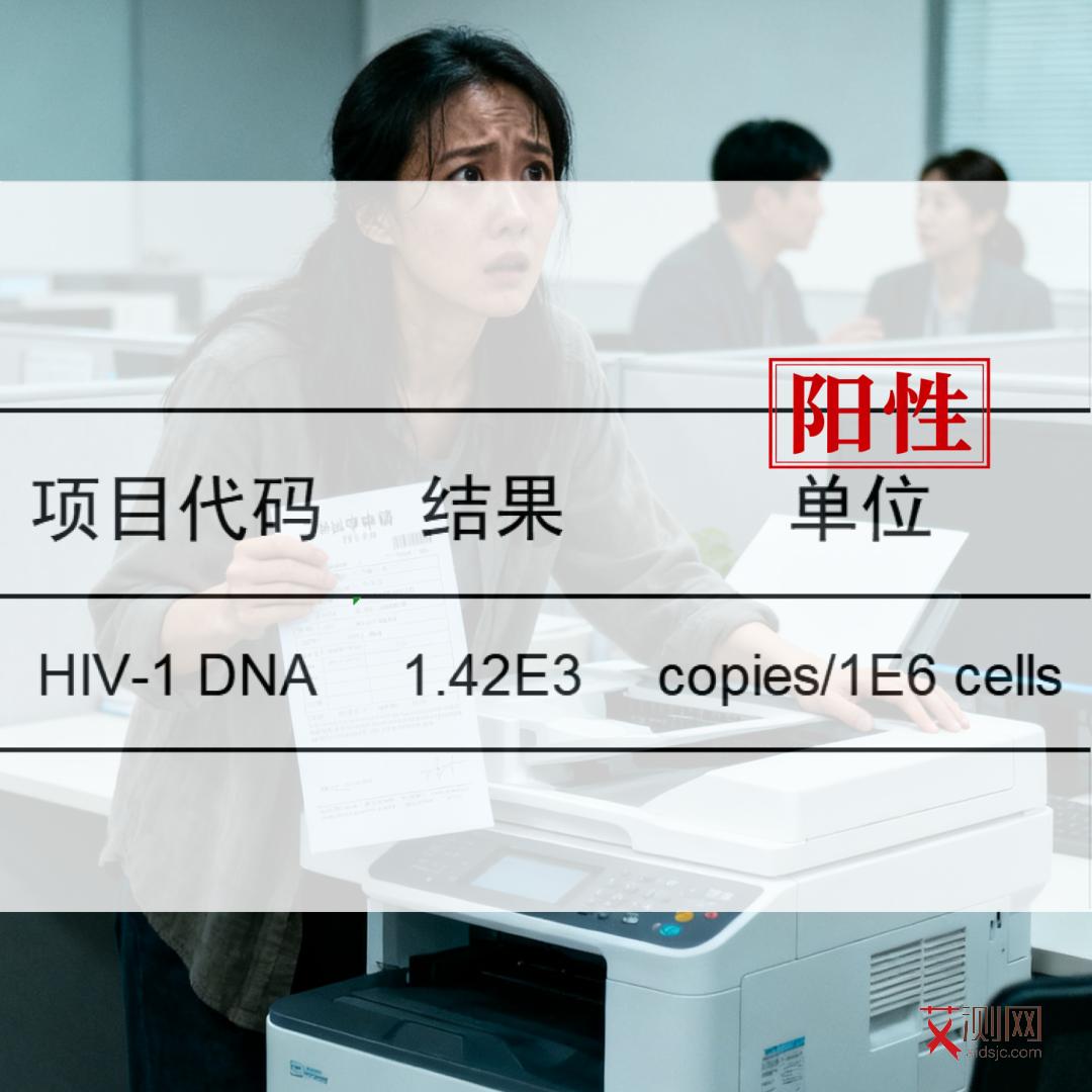 艾滋病的特点有哪些