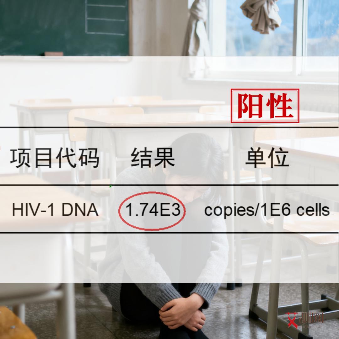 艾滋病的常见症状有啥图片