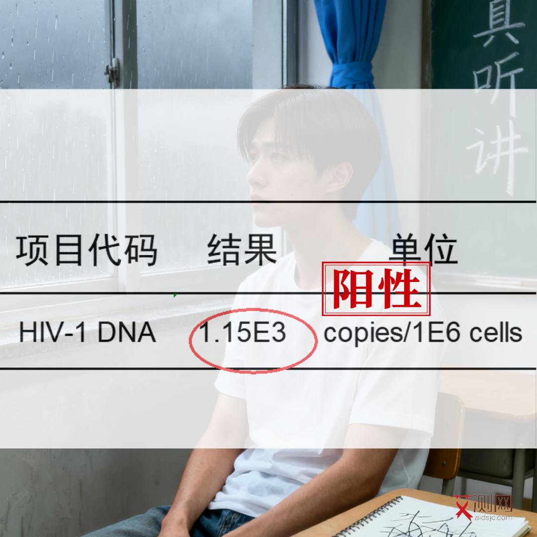 艾滋病引起的口腔溃疡图片真实