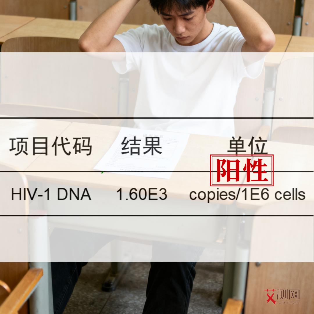 如何检查自己有没有艾滋病毒抗体检测