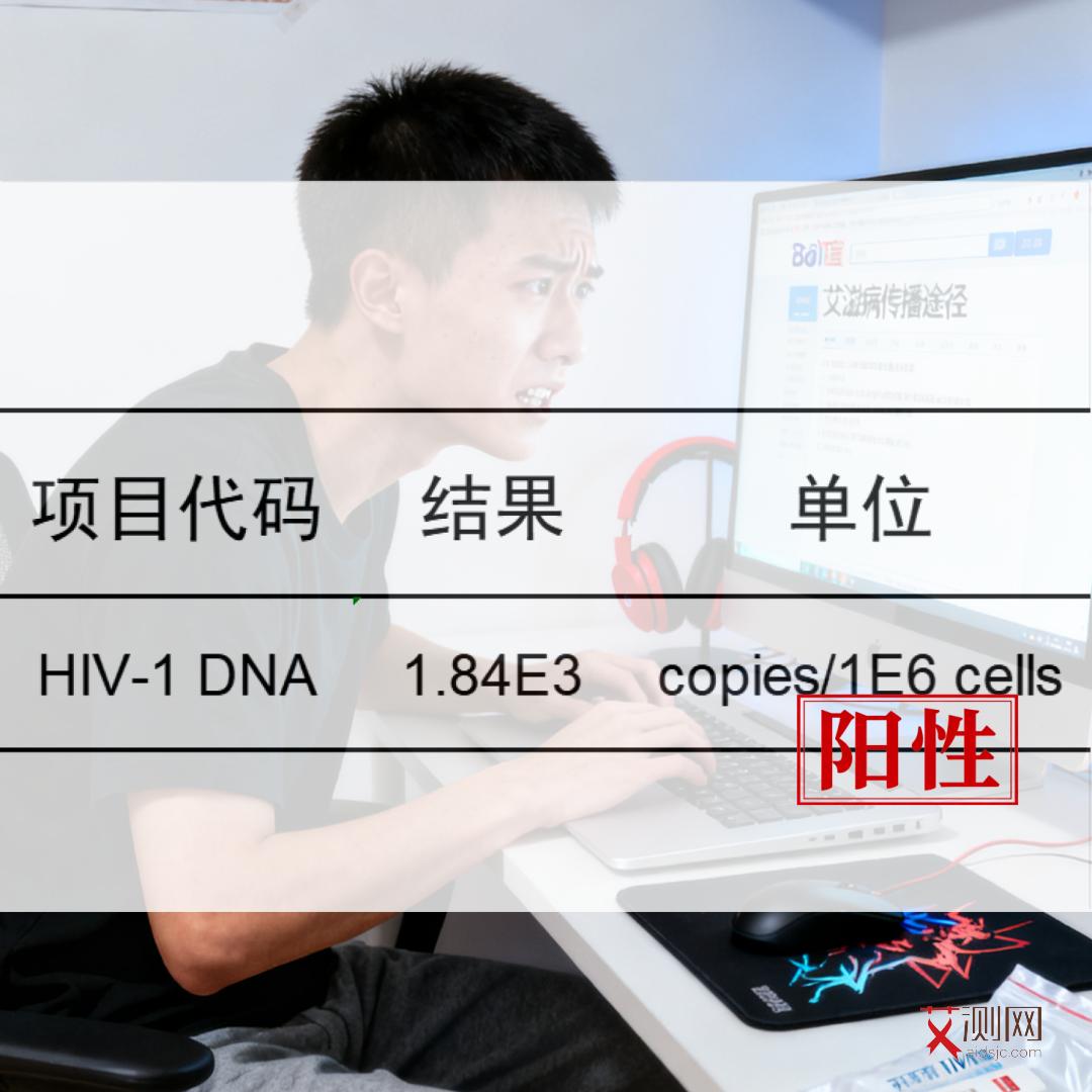 艾滋病的表现是什么症状图片大全图解
