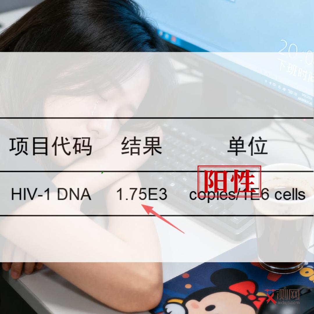 艾滋症状图片大全早期