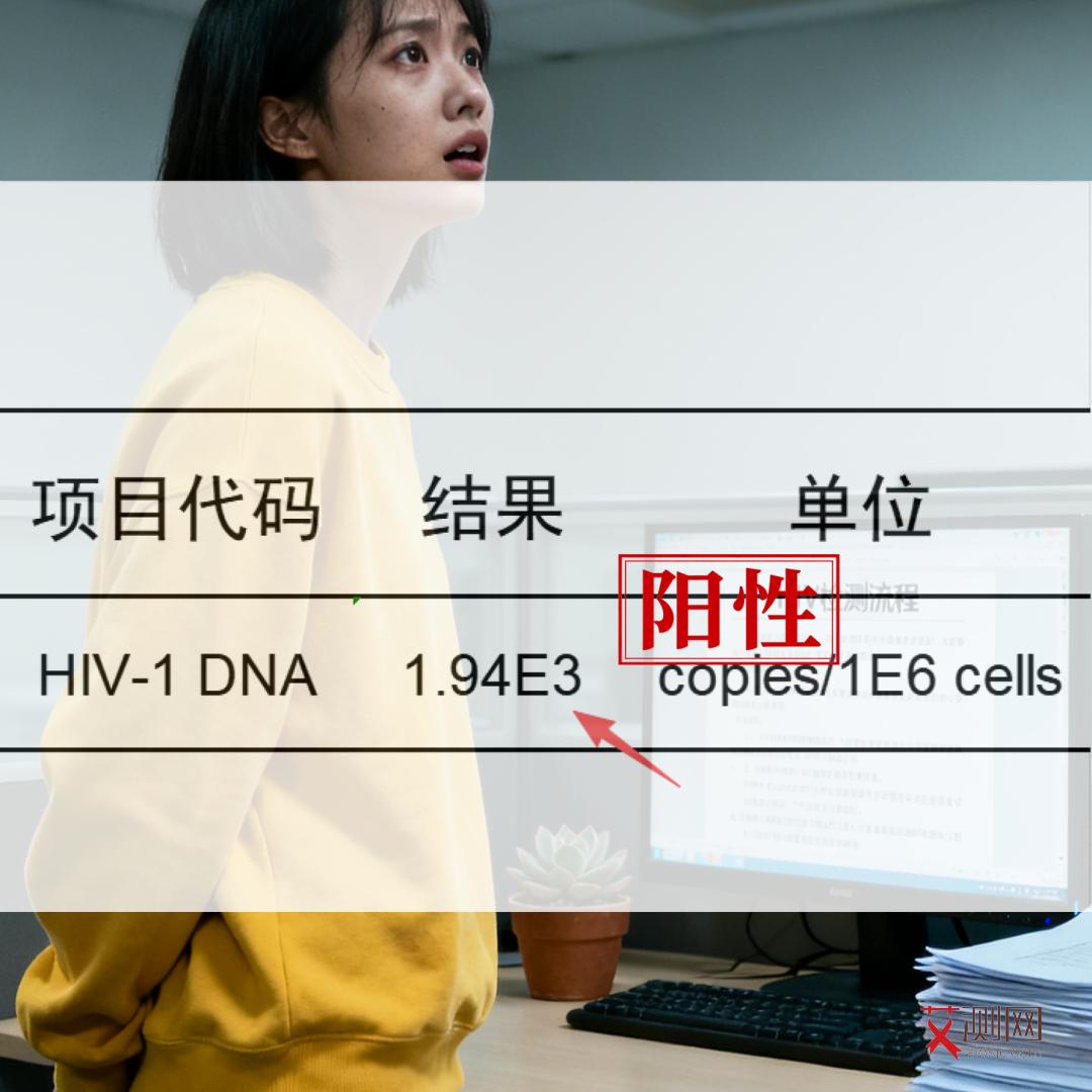 艾滋病的初期症状皮疹有哪些图片女性