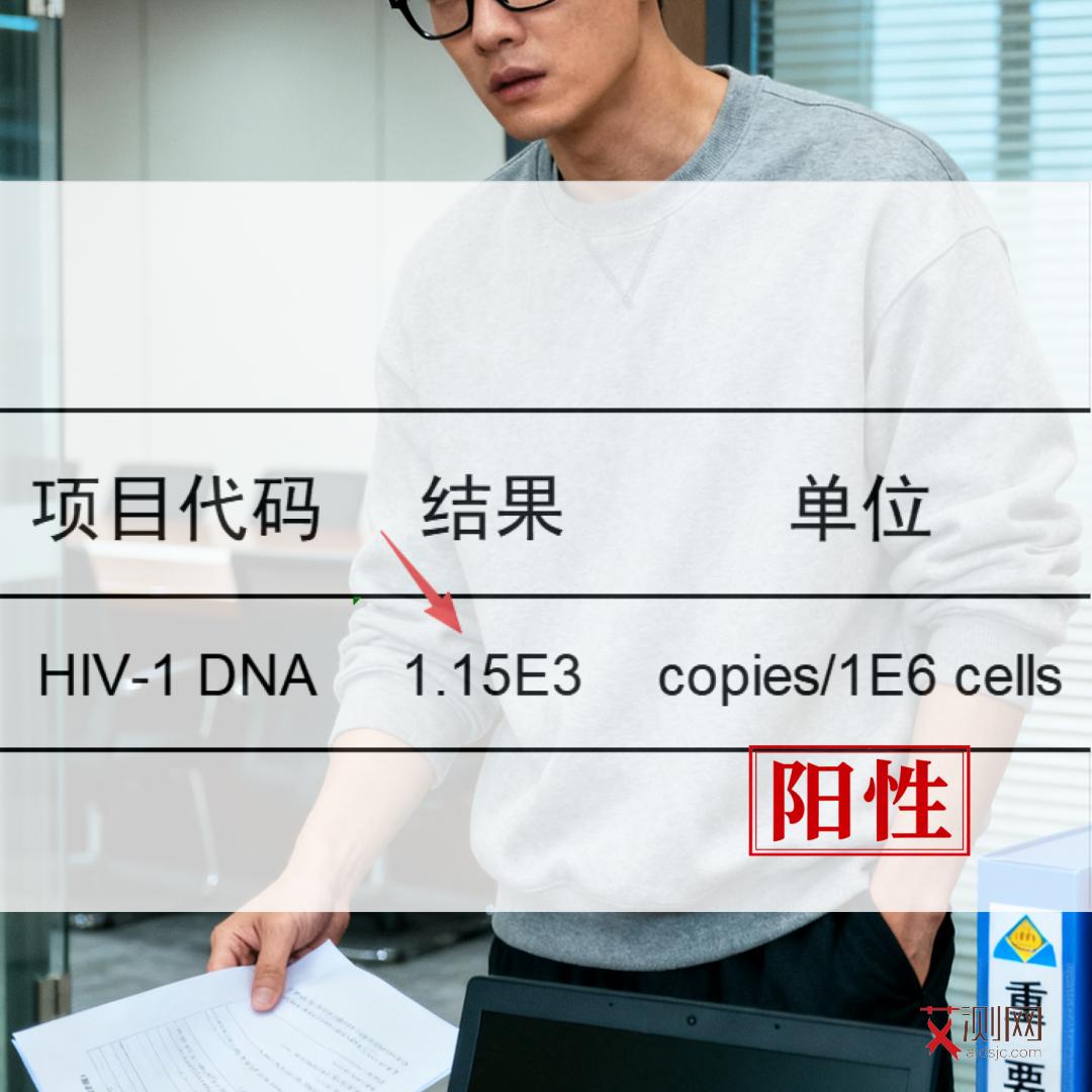 艾滋病前期有什么表现和症状