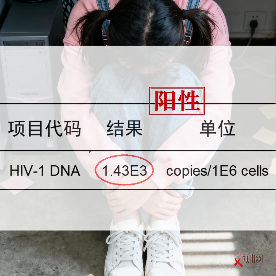 请问艾滋病有些什么症状表现呢女性