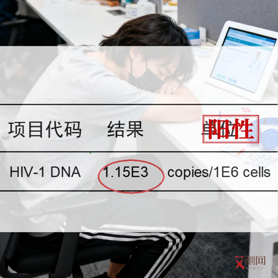 艾滋病患者女性下体会有异味吗