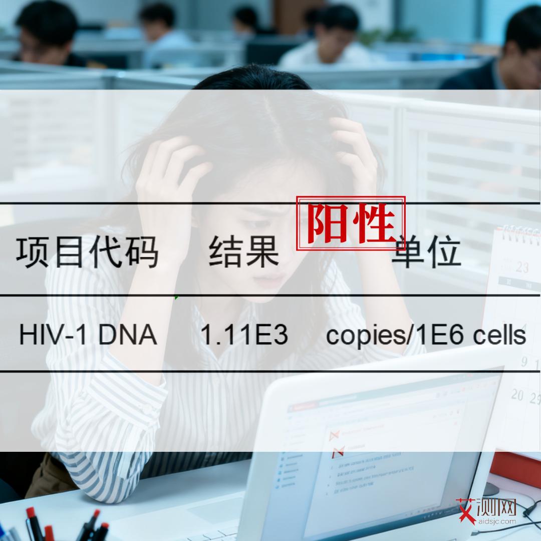 怎样检查自己有没有艾滋病毒抗体检测