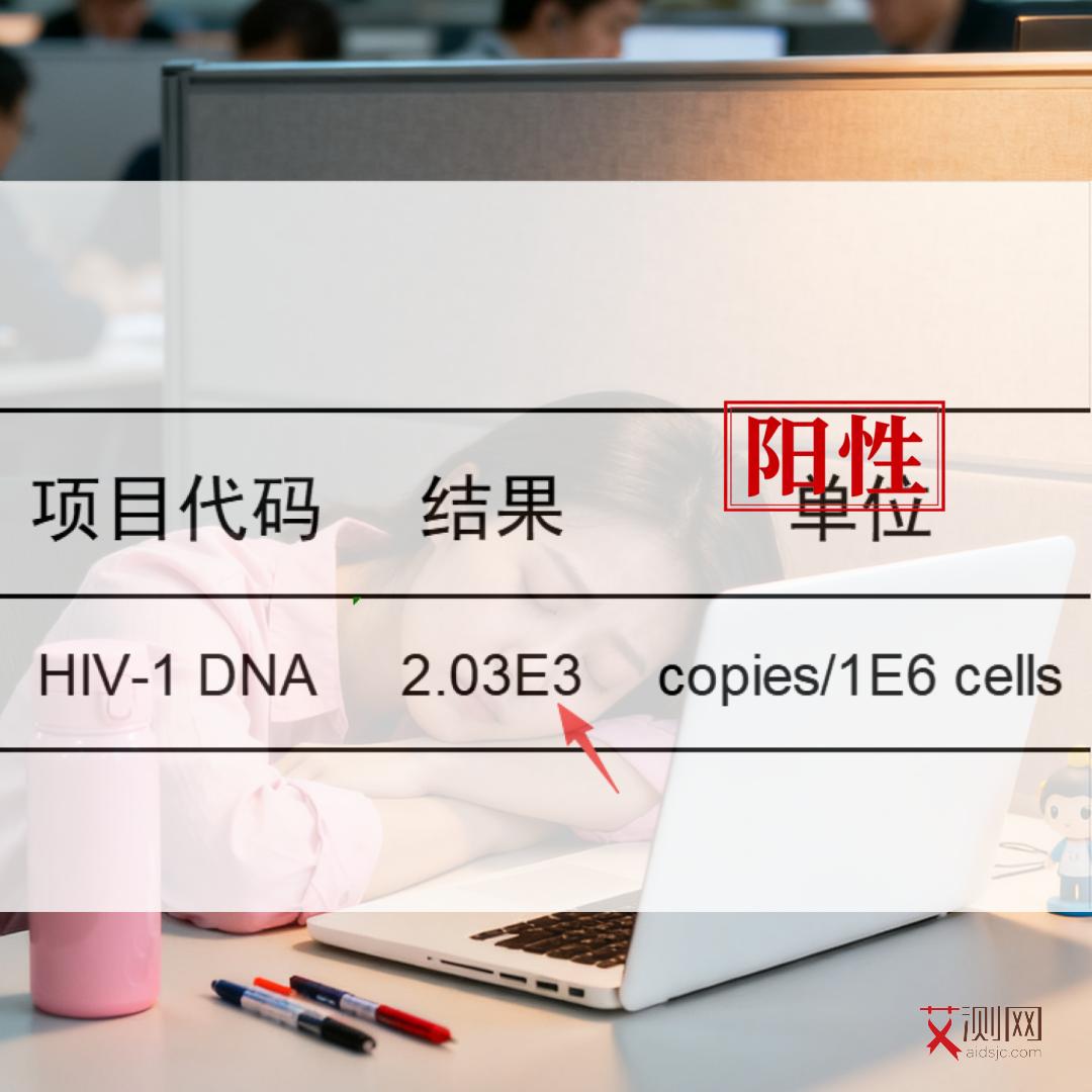 艾滋病症状多久能检测出来呢