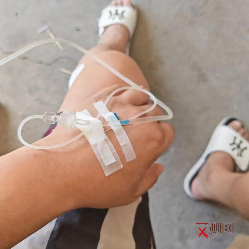 艾滋病的几个症状表现有哪些图片