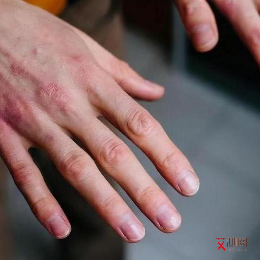 艾滋病到底多久能查出来是否感染成功