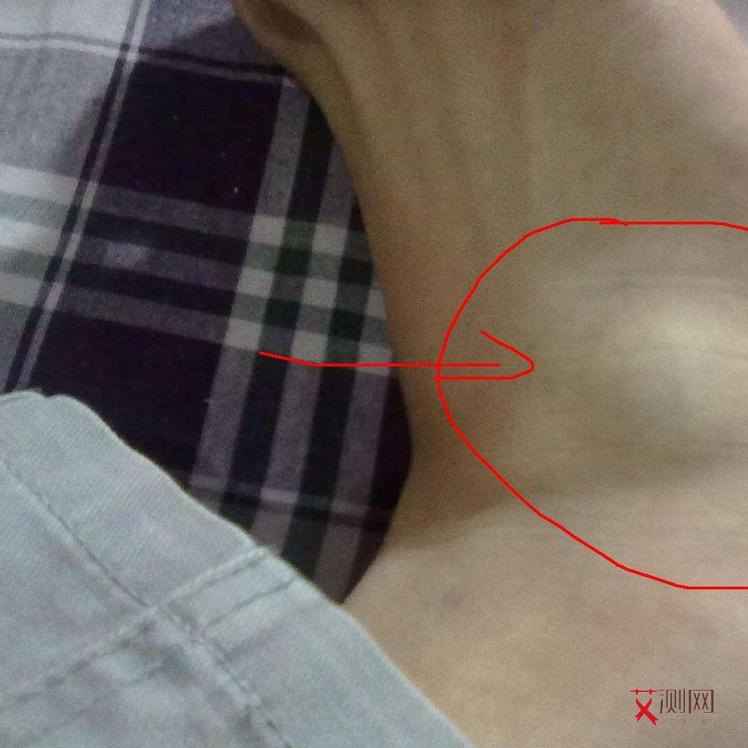 艾滋病发病后活多久会传染给别人