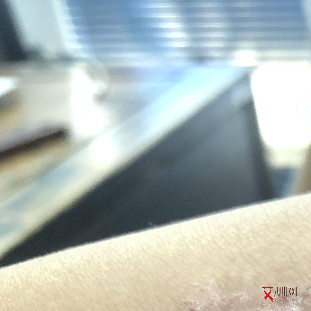 艾滋病有哪种症状