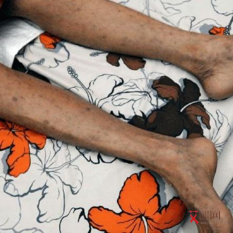 观看艾滋病心得体会