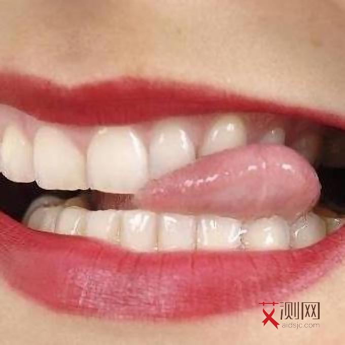 艾滋病最明显的症状有哪些临床表现为高发期和低发期