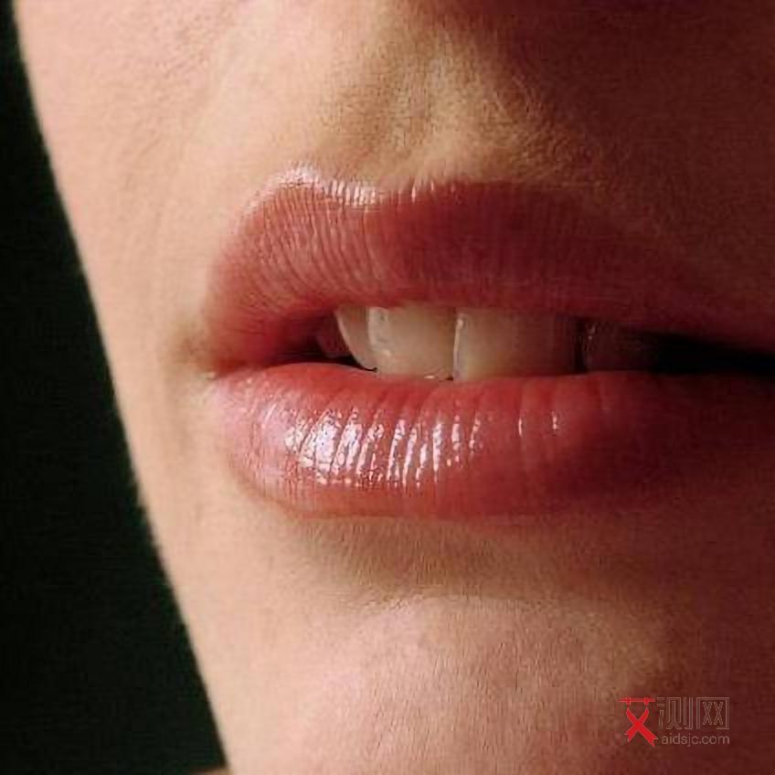 艾滋病的常见症状表现