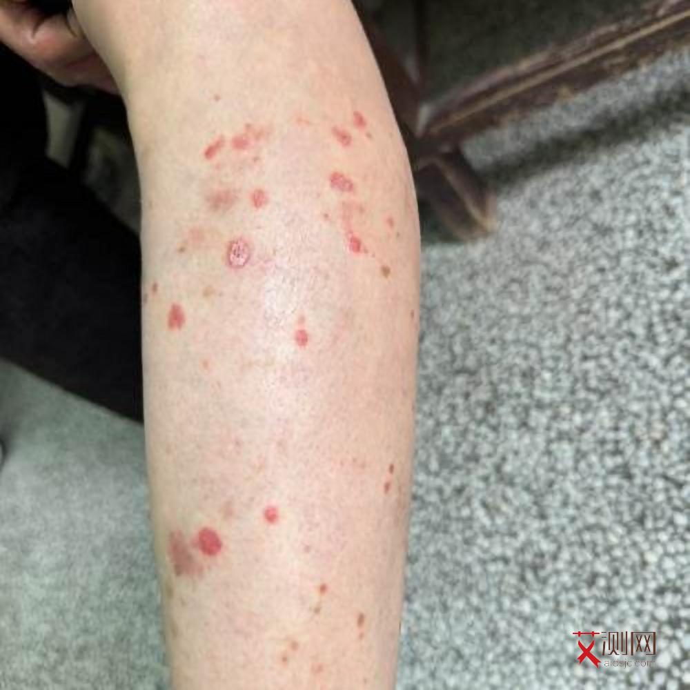 感染艾滋病多长时间能发现?