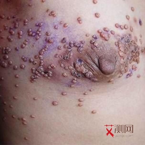 什么叫艾滋病高危行为呢图片大全