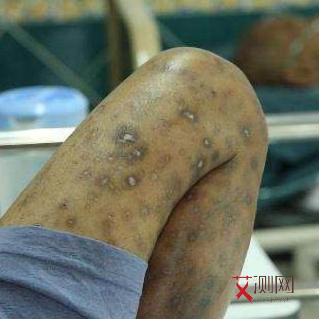 艾滋病会不会怀孕生孩子