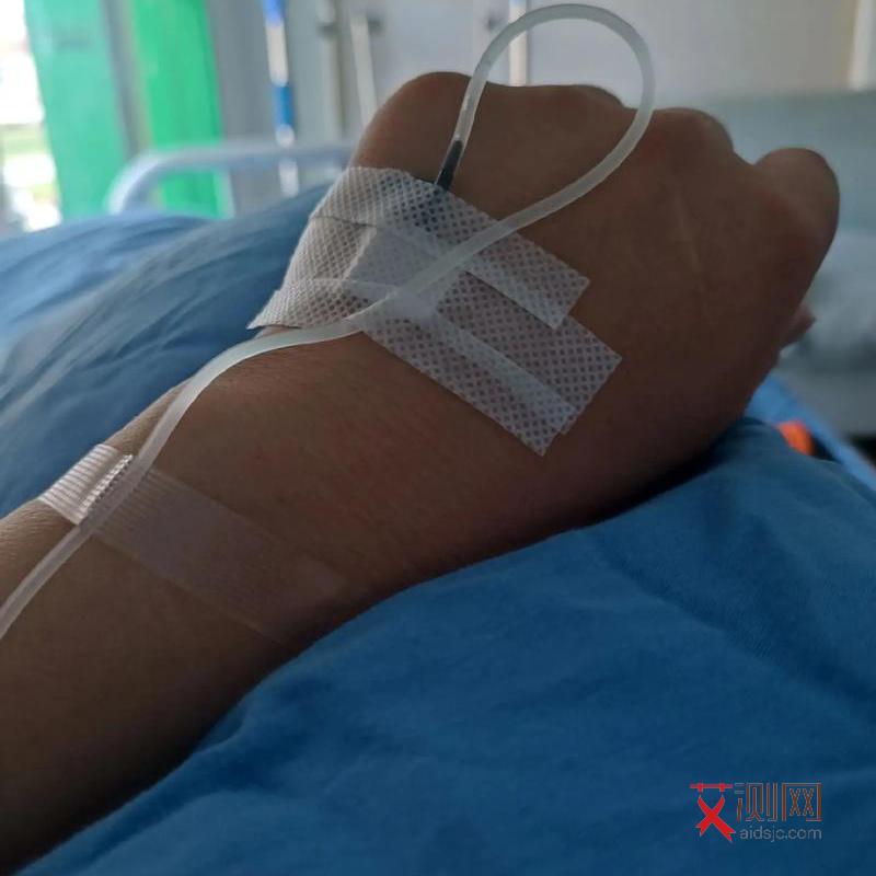 艾滋病初期身上红点会痒吗图片女