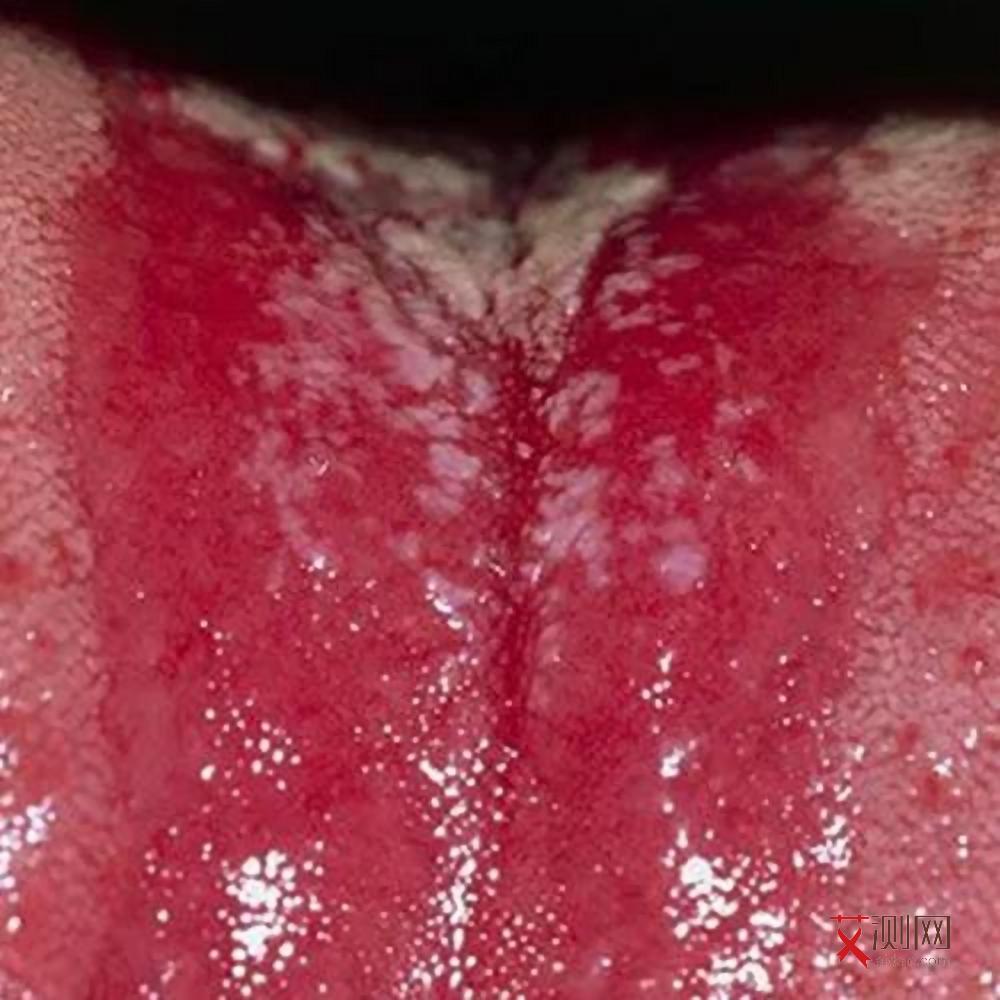 艾滋病过几天才有症状