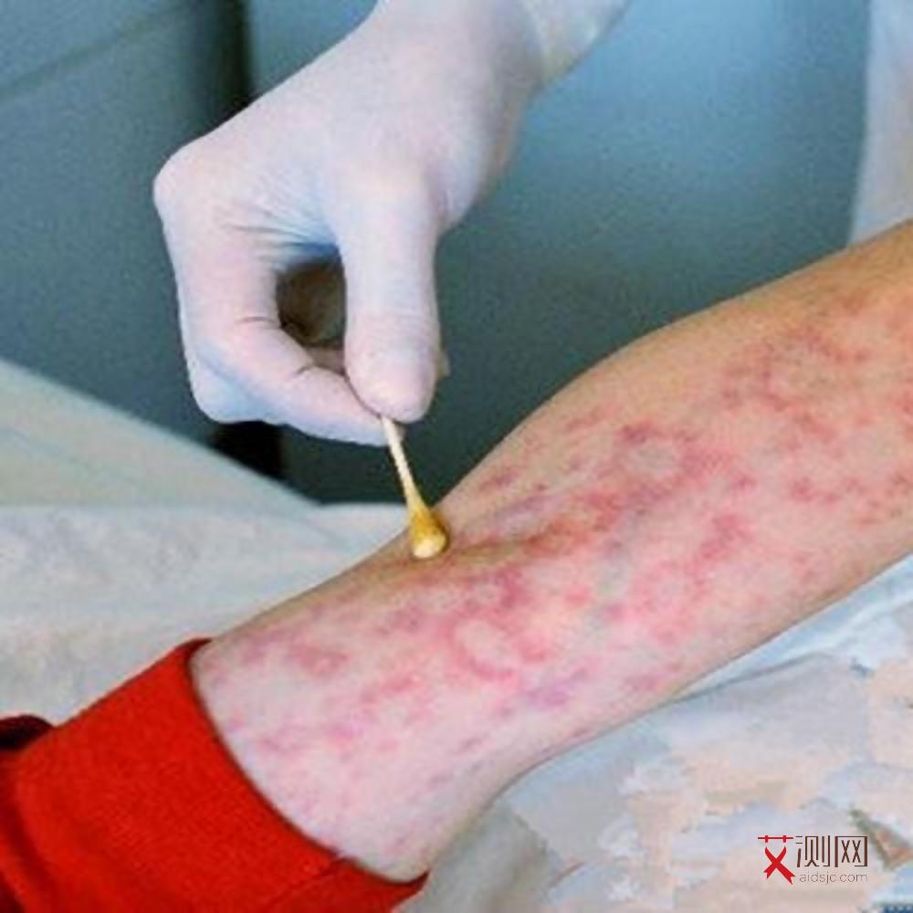 艾滋病女性会怀孕吗会流产吗会流产吗