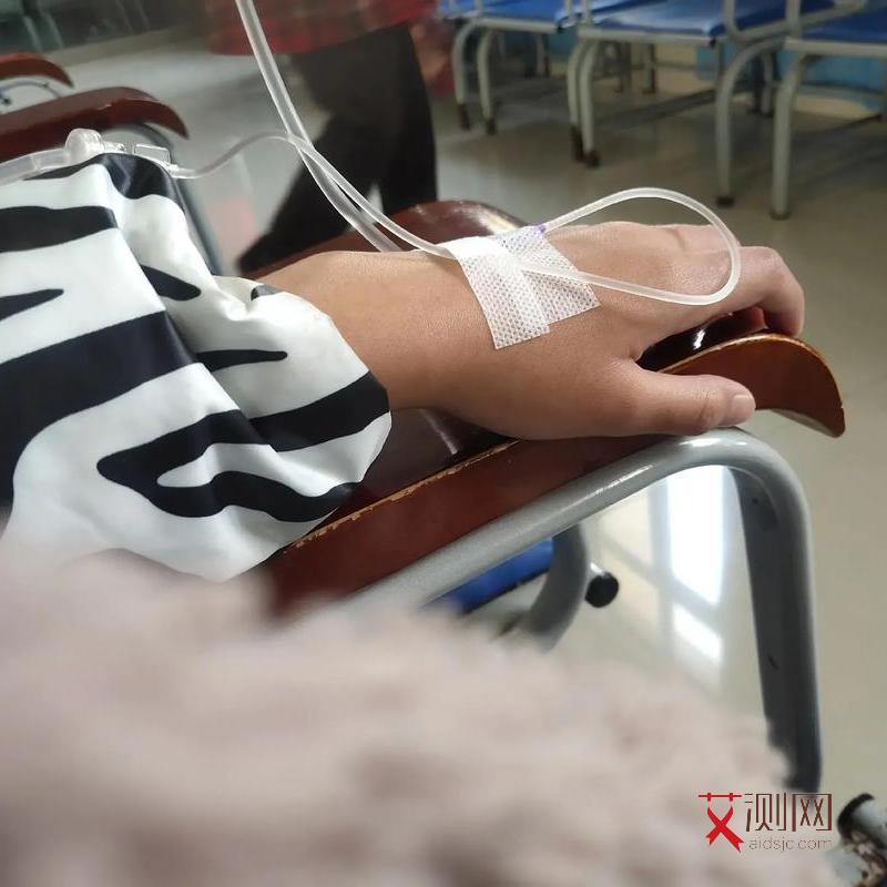 得了艾滋病皮疹图片真实