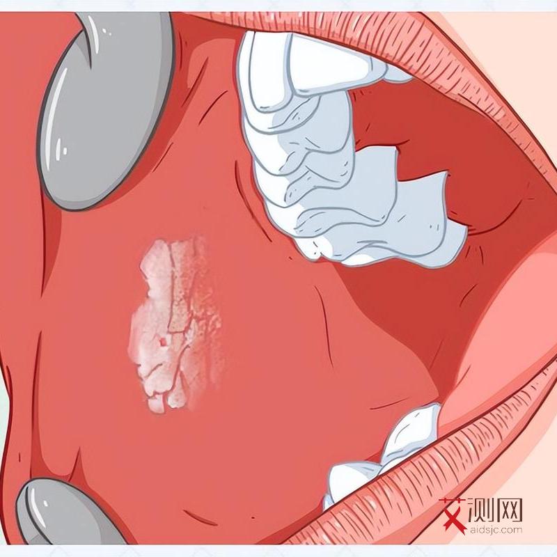艾滋病发病期能活几个月啊