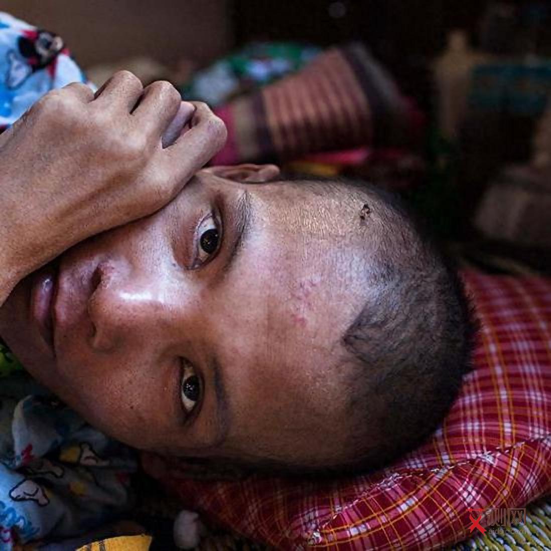 艾滋病小红点会不会凸起