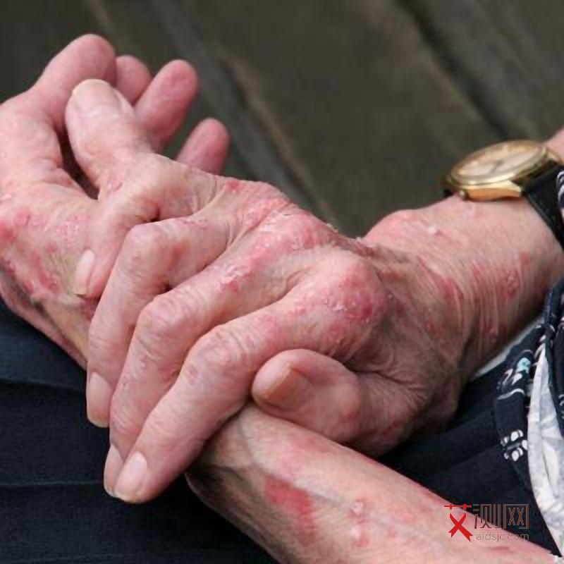 艾滋病下体有味道吗女性会传染吗