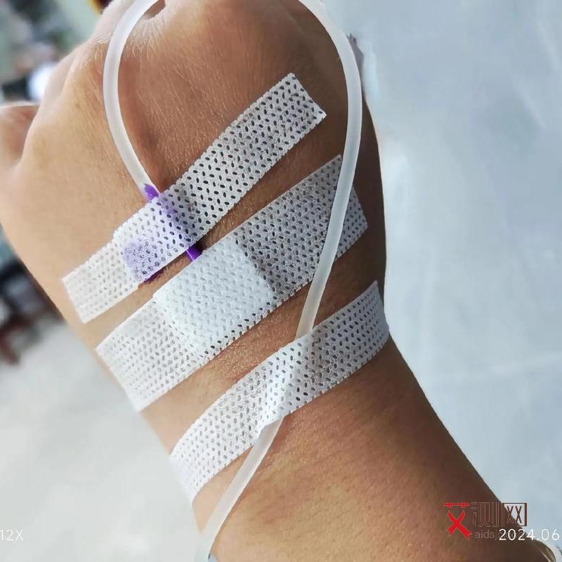 艾滋病的人的症状图片大全真实