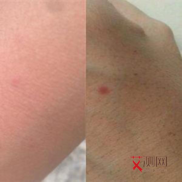 艾滋病有潜伏期么