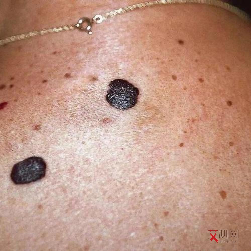 天津市艾滋病阻断药哪里有