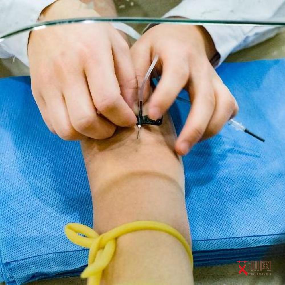 艾滋病会出现女性生殖器,出血吗女性