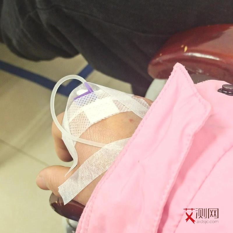 艾滋病下体症状和表现图片大全女