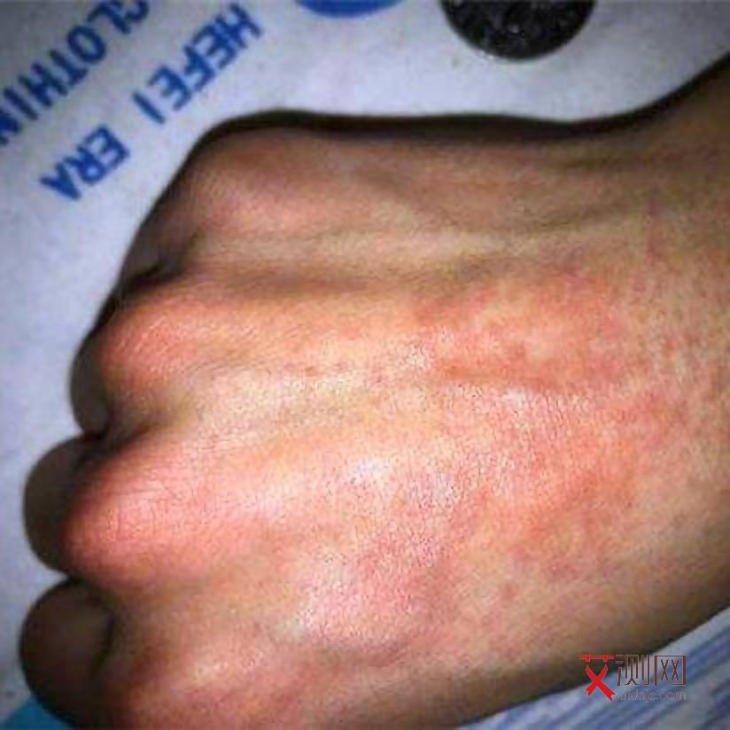 艾滋病的全国比例图16:9是什么情况