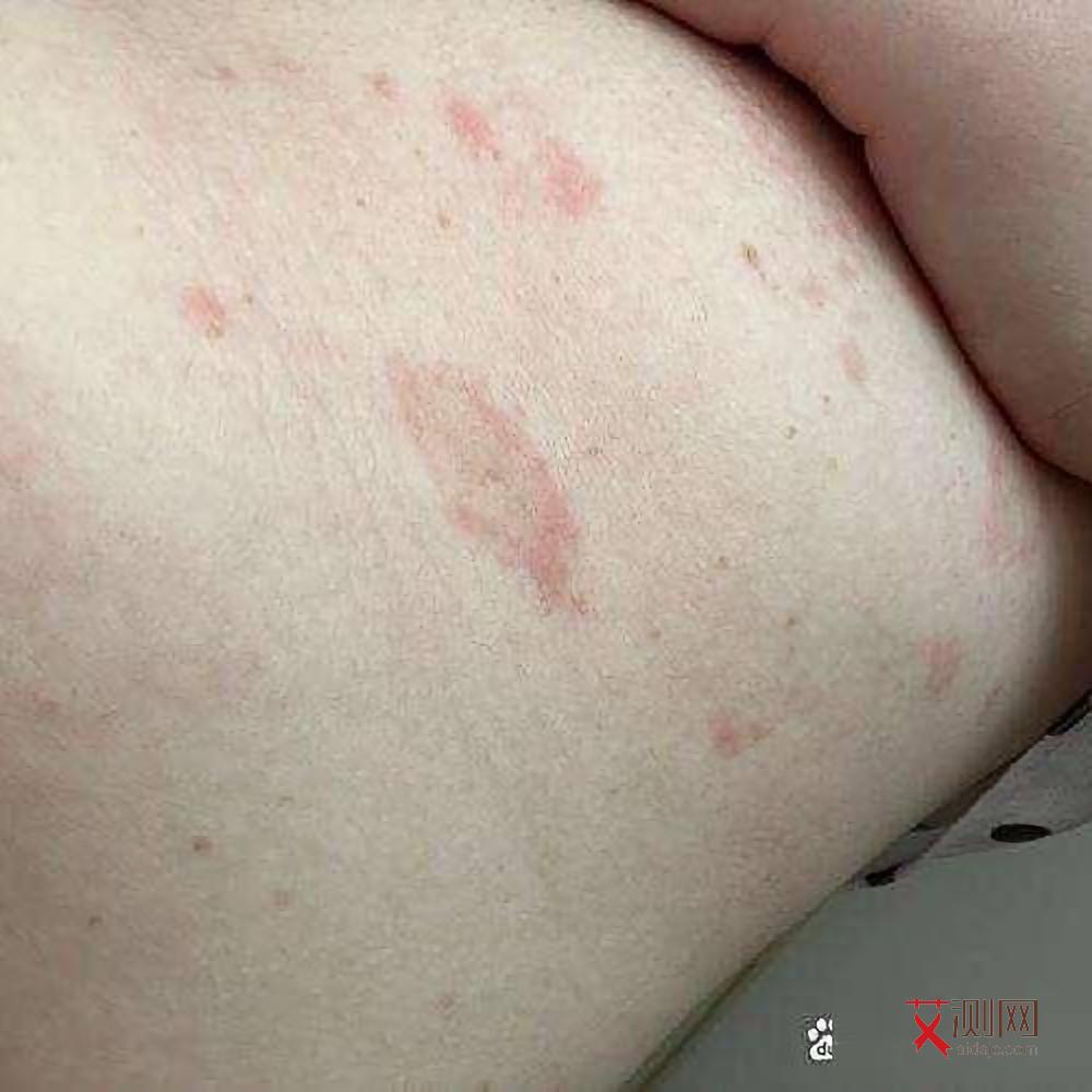 艾滋病多久能查出来一般需要几周