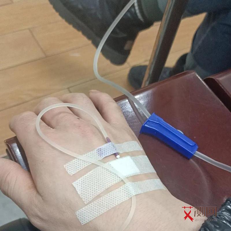 艾滋的早期口腔症状图片大全