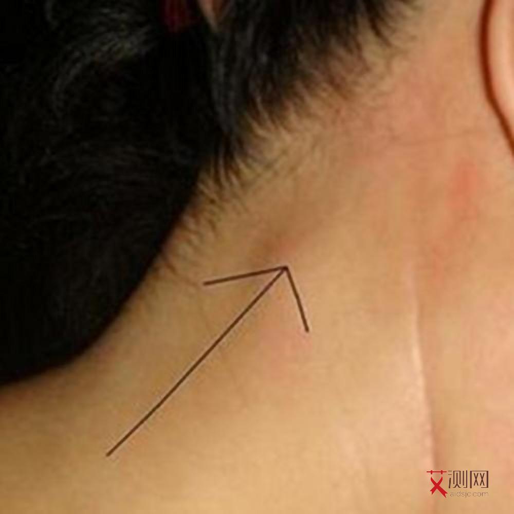 艾滋病下体痒痒吗图片女士