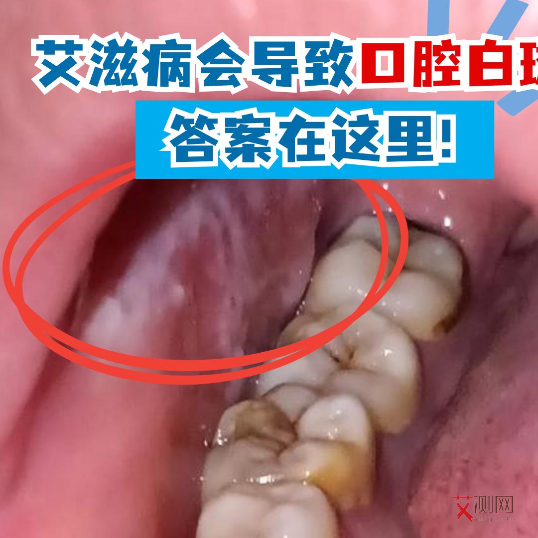 艾滋病高危和低危的区别在哪里