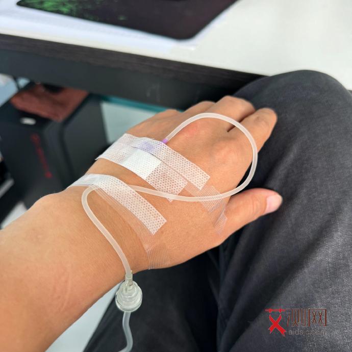 艾滋病初期下面有什么反应