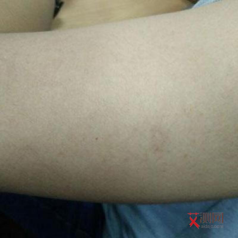 怎么判断自己有没有得艾滋病