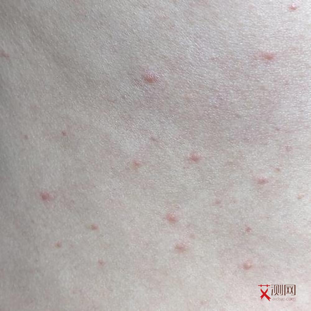 没有高危会得艾滋么