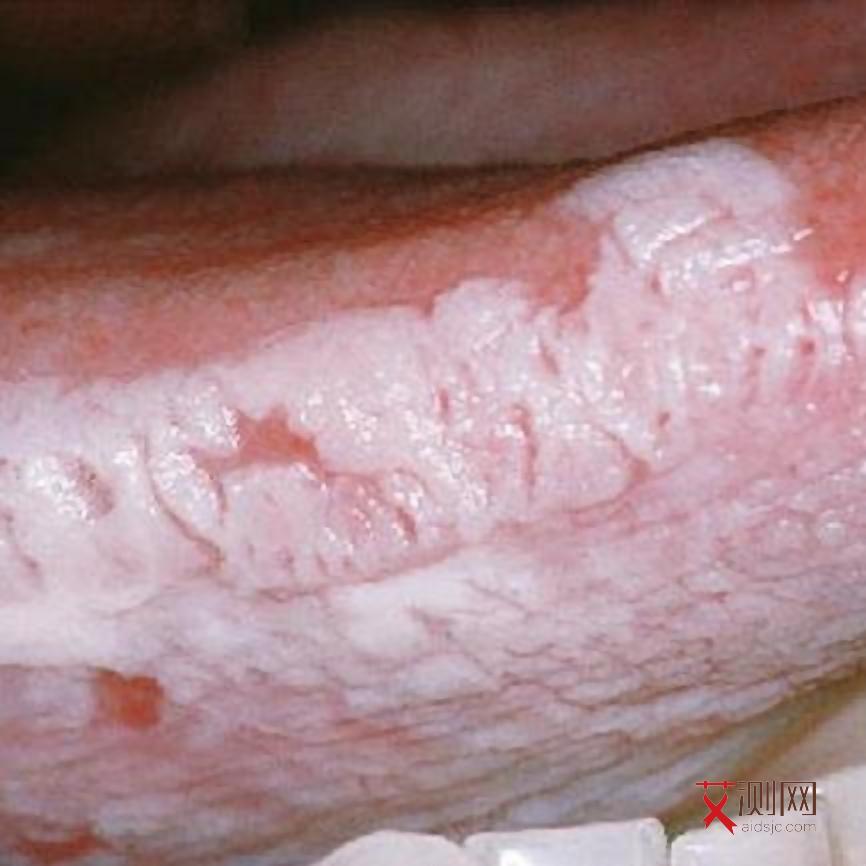 高危行为后多久可以查艾滋病毒抗体