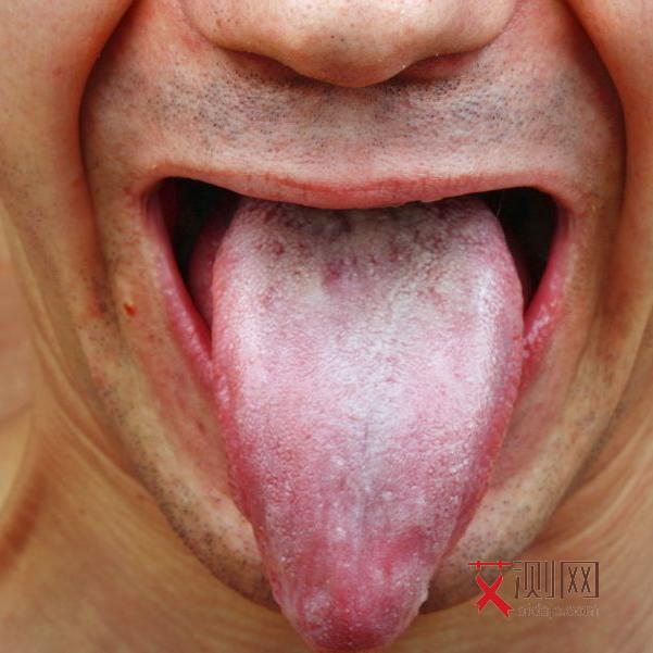 艾滋病身上起红色的包图片