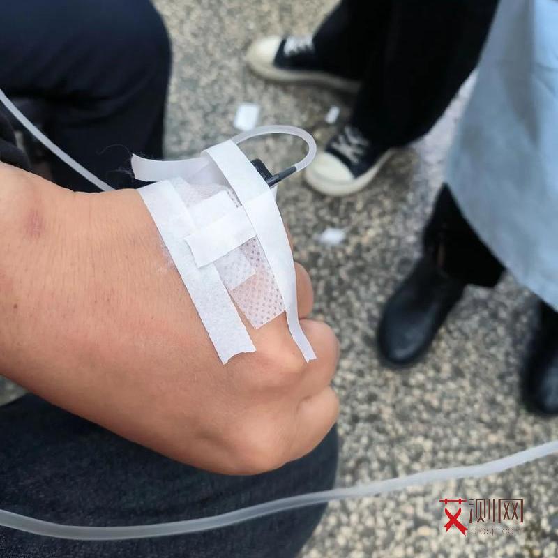 口腔烫伤会感染艾滋吗