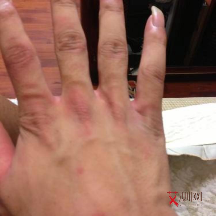 艾滋病多久会显现