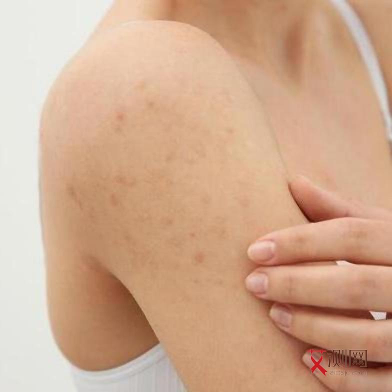 艾滋几天后会出现症状