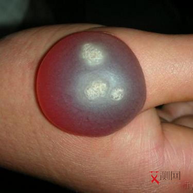 如何检查自己有没有艾滋病感染艾滋病毒的可能