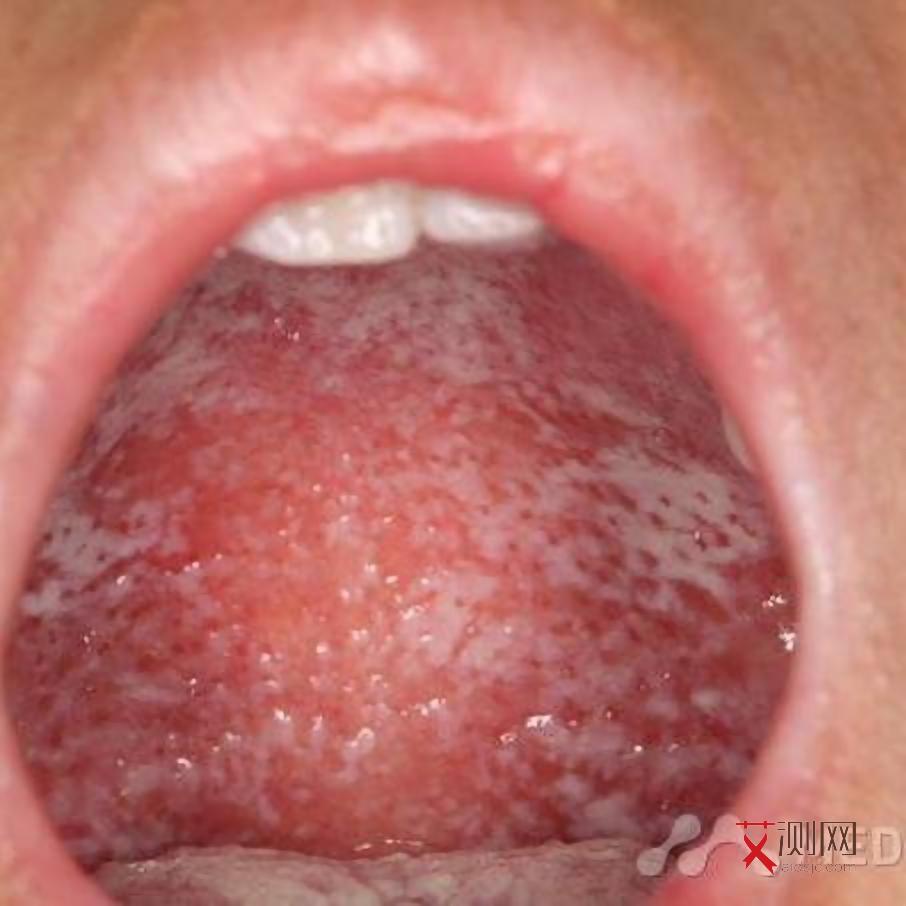 疾控中心有没有感染艾滋的可能性