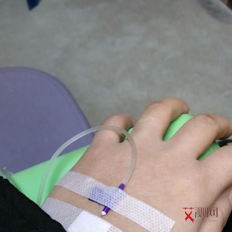 感染艾滋病多久身上会出现皮疹